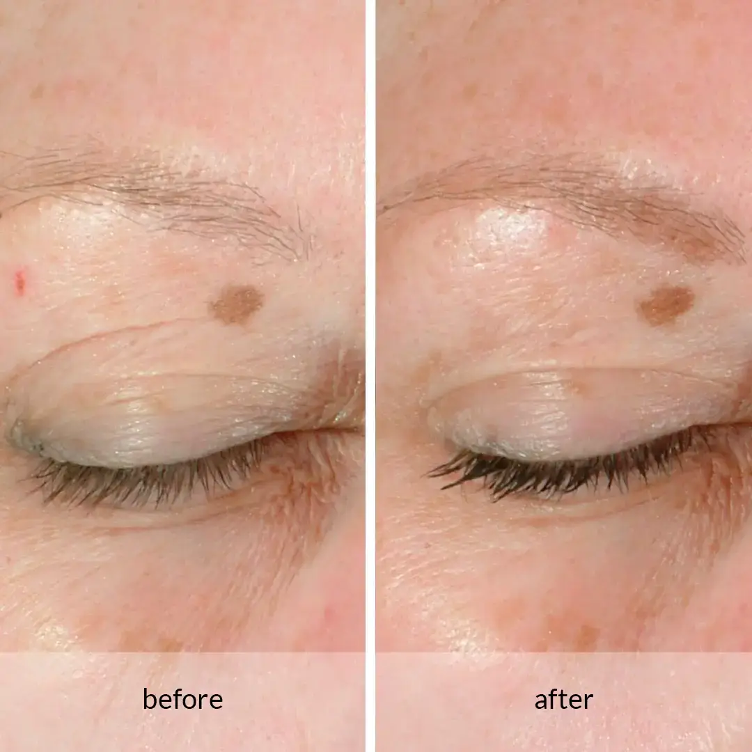 ANEW Platinum Lift & Tighten Dual Eye System - Afbeelding 4